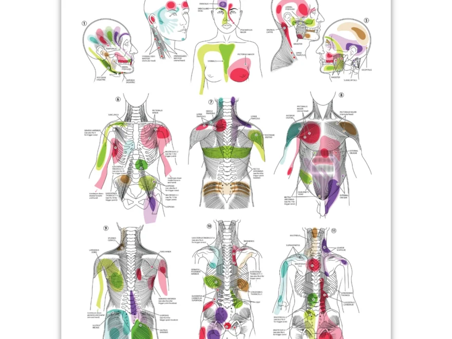 Anatomy Lab Trigger Points I Laminated Poster Anatomy Warehouse