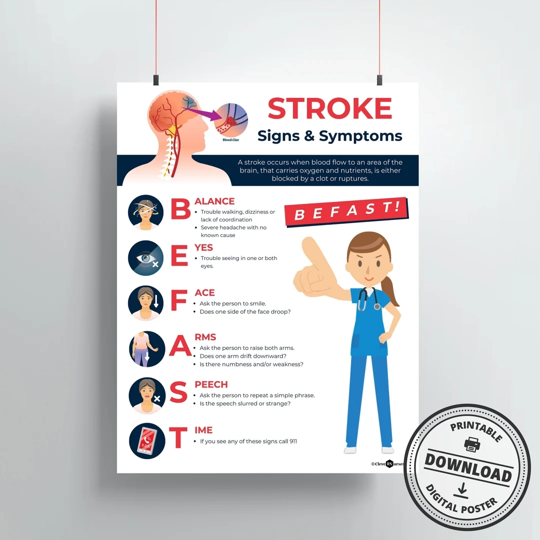 Printable Acronym For Signs Of Stroke Printable Acronym For Signs Of Stroke