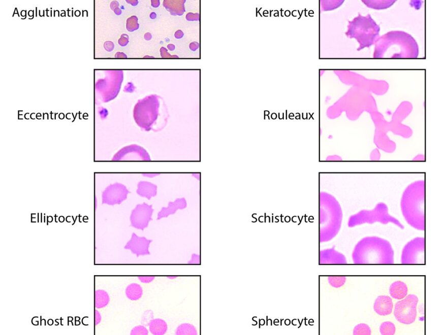 RBC Morphology EClinpath