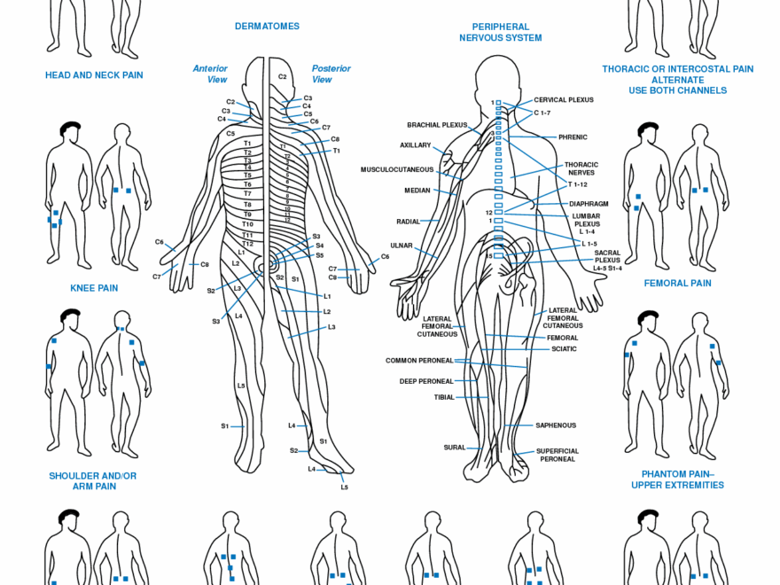 Discover 10 Tens Unit Placement Charts And Tens Machine Ideas K Tape Ems Electrode Placement Muscle Dermatone Chart And More