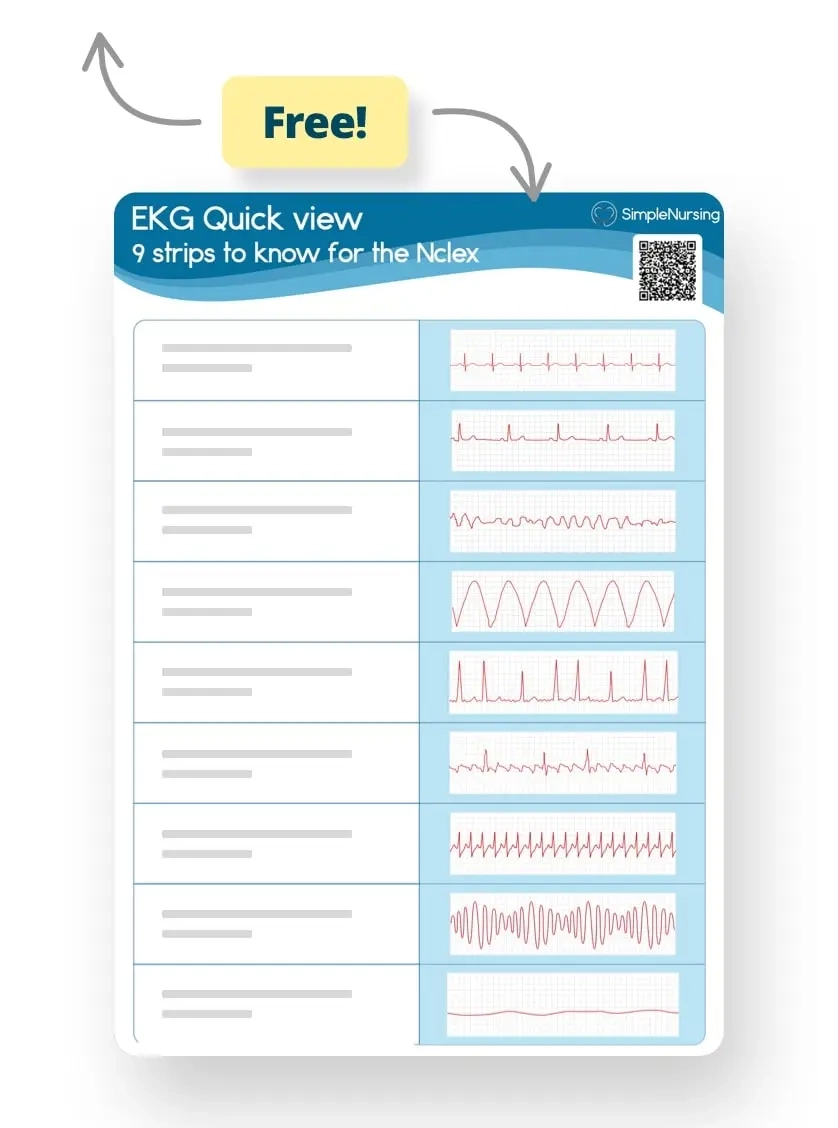 EKG Interpretation Rhythms And Strips Cheat Sheet
