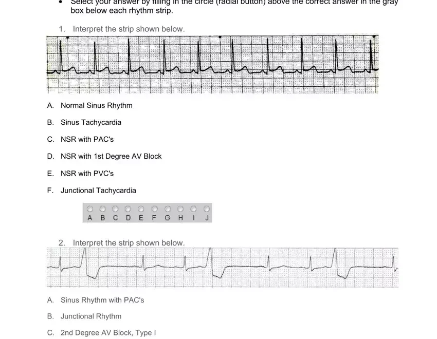 Ekg Practice Form Fill Out Printable PDF Forms Online