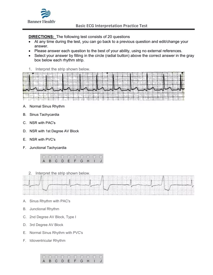 Ekg Practice Form Fill Out Printable PDF Forms Online